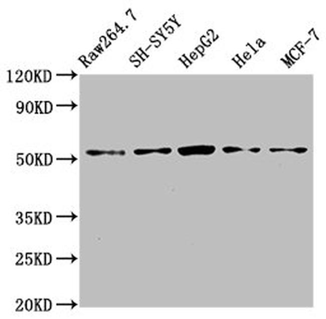 MATN3 Antibody in Western Blot (WB)