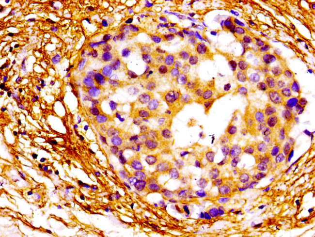 MAZ Antibody in Immunohistochemistry (Paraffin) (IHC (P))