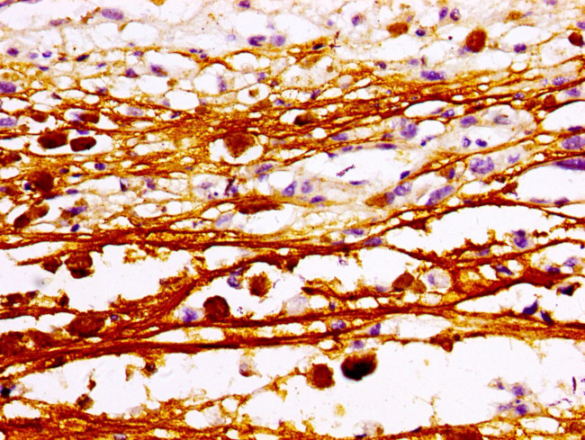 MAZ Antibody in Immunohistochemistry (Paraffin) (IHC (P))