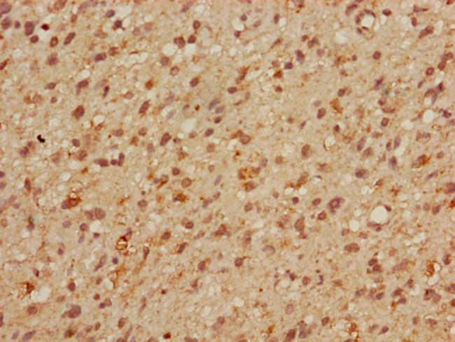 MBD3 Antibody in Immunohistochemistry (Paraffin) (IHC (P))