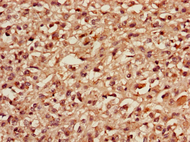 MBD3 Antibody in Immunohistochemistry (Paraffin) (IHC (P))