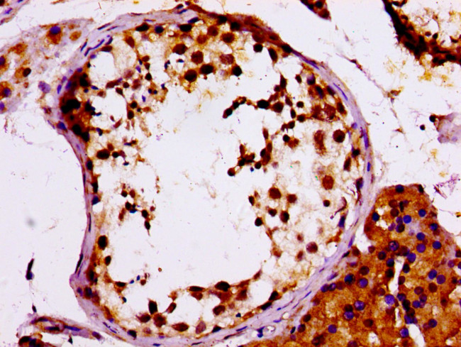 MCM4 Antibody in Immunohistochemistry (Paraffin) (IHC (P))