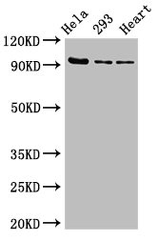 MCM4 Antibody in Western Blot (WB)