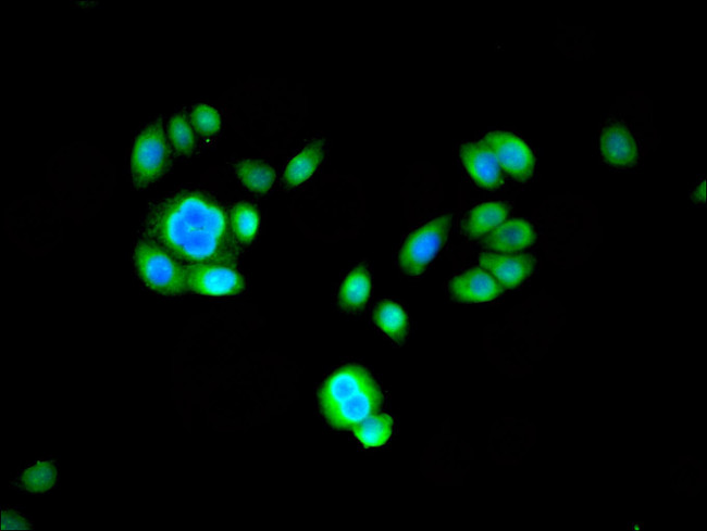 PSMB2 Antibody in Immunocytochemistry (ICC/IF)