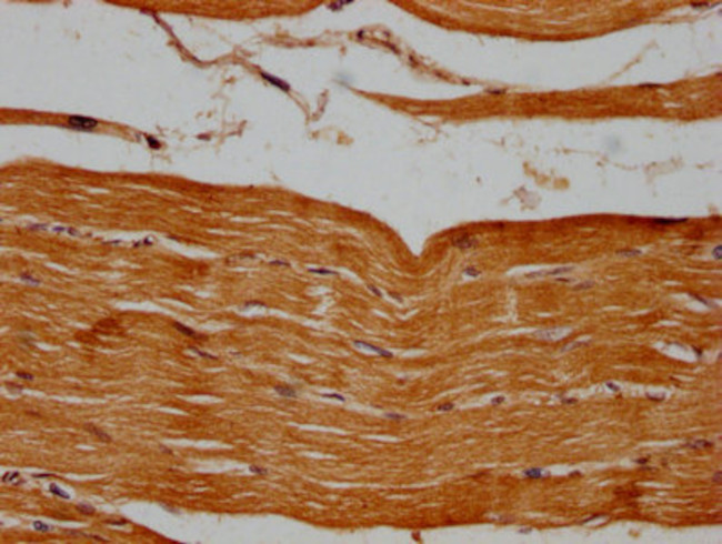 PSMB2 Antibody in Immunohistochemistry (Paraffin) (IHC (P))