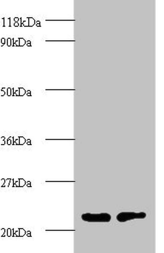 PSMB2 Antibody in Western Blot (WB)