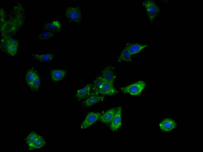 MCD Antibody in Immunocytochemistry (ICC/IF)