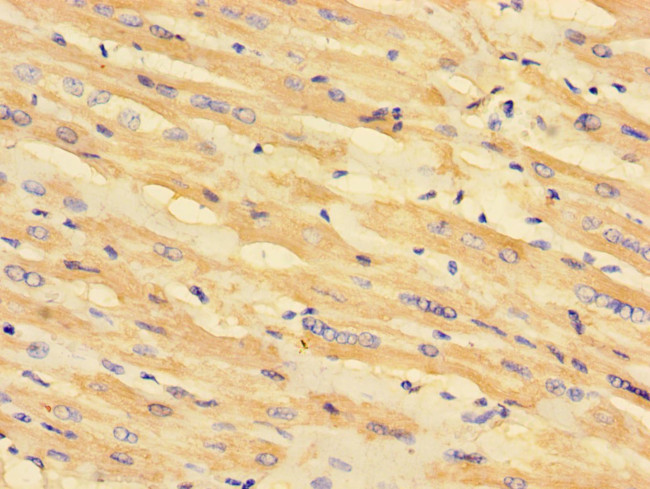 MCD Antibody in Immunohistochemistry (Paraffin) (IHC (P))