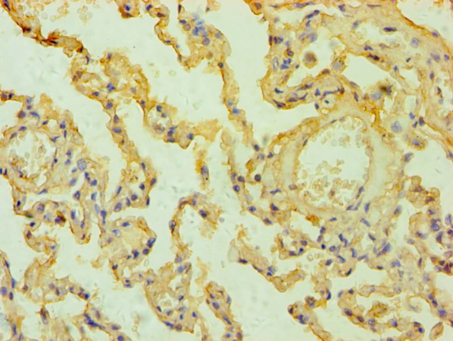 Mesothelin Antibody in Immunohistochemistry (Paraffin) (IHC (P))