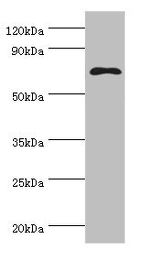 Mesothelin Antibody in Western Blot (WB)