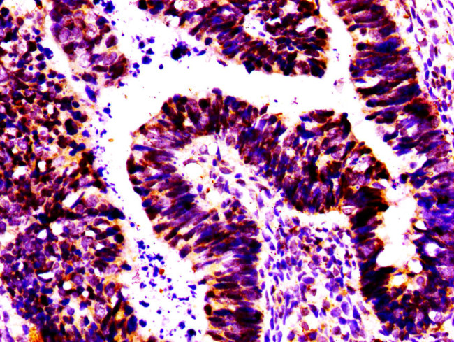 MSX2 Antibody in Immunohistochemistry (Paraffin) (IHC (P))