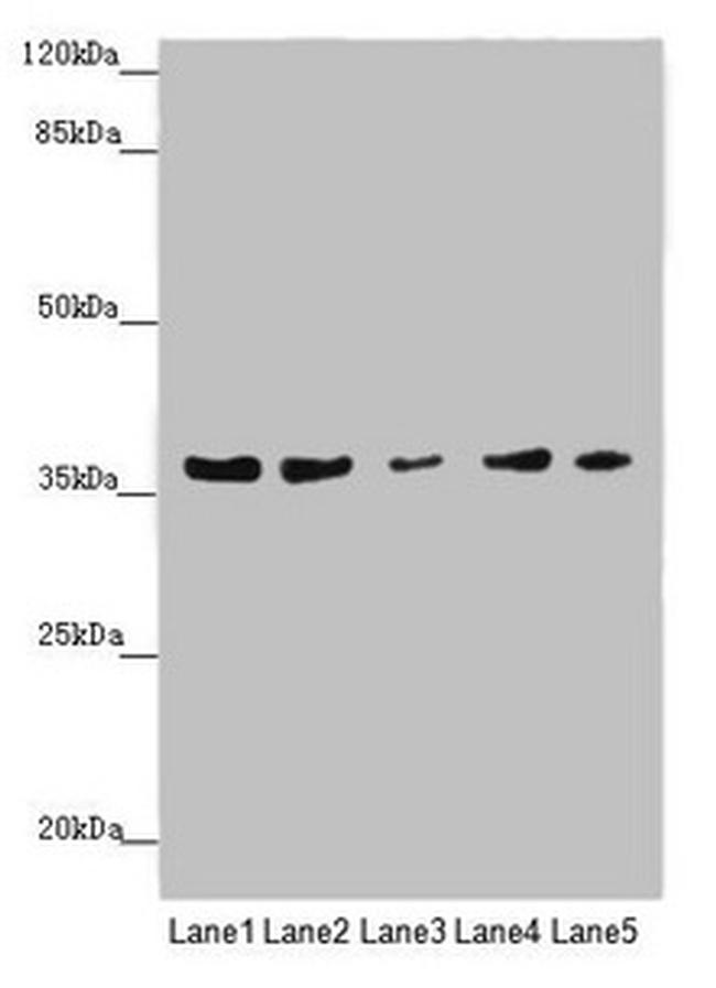 MTHFD2 Antibody in Western Blot (WB)