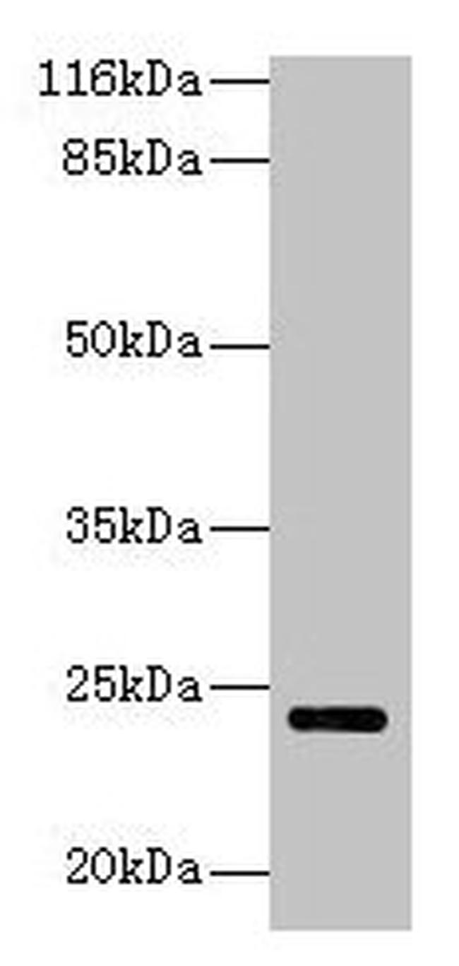 MTHFS Antibody in Western Blot (WB)