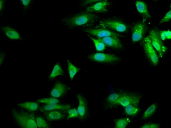 MVD Antibody in Immunocytochemistry (ICC/IF)