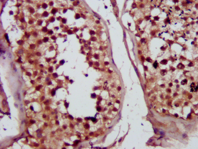 MVD Antibody in Immunohistochemistry (Paraffin) (IHC (P))