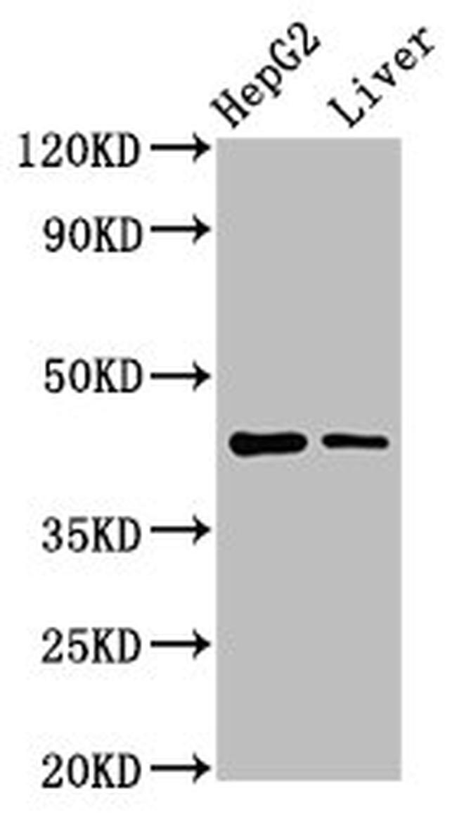 MVD Antibody in Western Blot (WB)