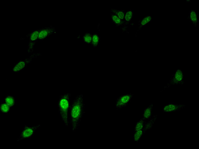 NCF2 Antibody in Immunocytochemistry (ICC/IF)