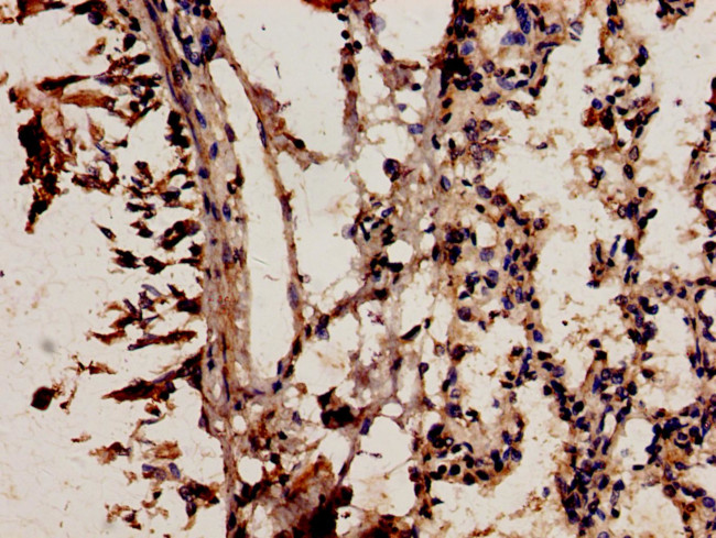 NCF2 Antibody in Immunohistochemistry (Paraffin) (IHC (P))