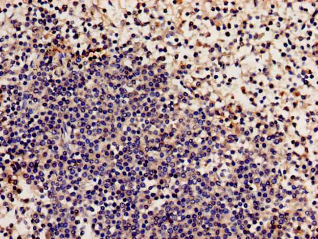 NCF2 Antibody in Immunohistochemistry (Paraffin) (IHC (P))