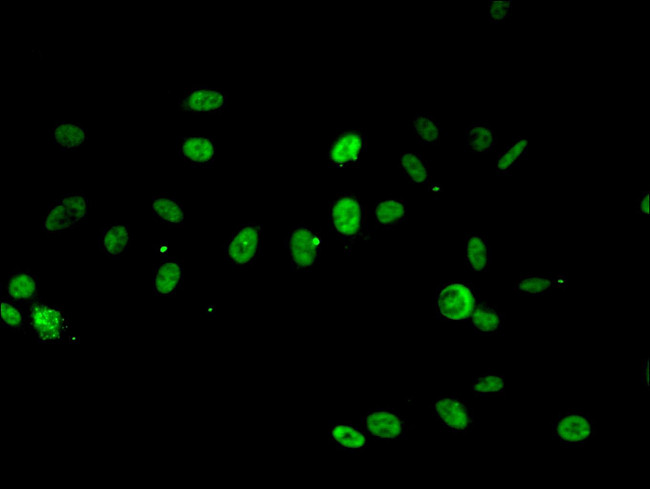 RPA2 Antibody in Immunocytochemistry (ICC/IF)