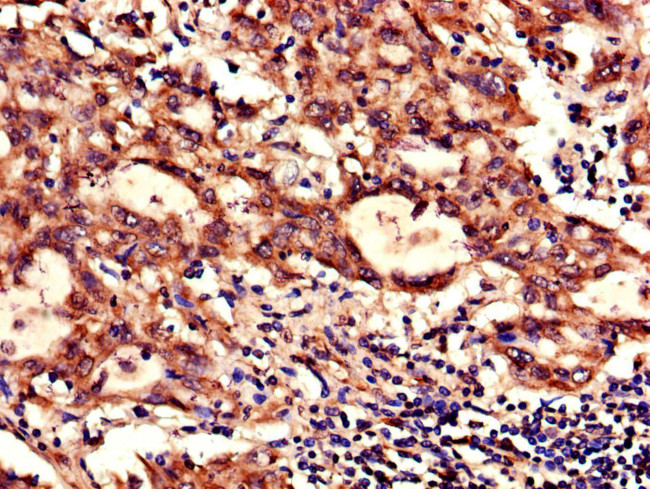 NDUFB6 Antibody in Immunohistochemistry (Paraffin) (IHC (P))