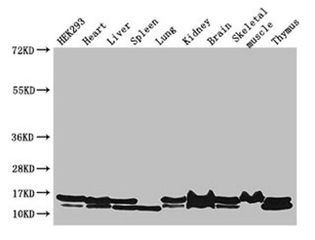 NDUFB6 Antibody in Western Blot (WB)