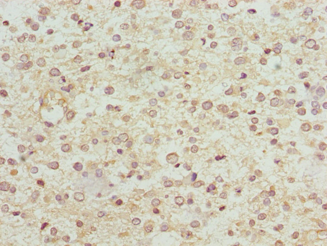 NDUFS1 Antibody in Immunohistochemistry (Paraffin) (IHC (P))