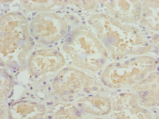 NDUFS1 Antibody in Immunohistochemistry (Paraffin) (IHC (P))