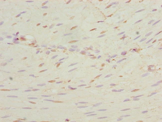 NEK3 Antibody in Immunohistochemistry (Paraffin) (IHC (P))