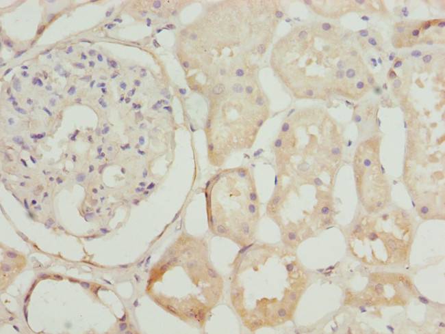 NEK3 Antibody in Immunohistochemistry (Paraffin) (IHC (P))