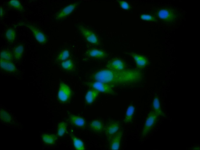 Nardilysin Antibody in Immunocytochemistry (ICC/IF)