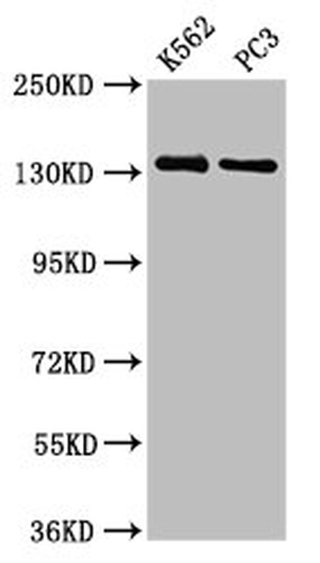 Nardilysin Antibody in Western Blot (WB)