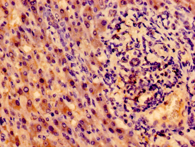 TrkA Antibody in Immunohistochemistry (Paraffin) (IHC (P))