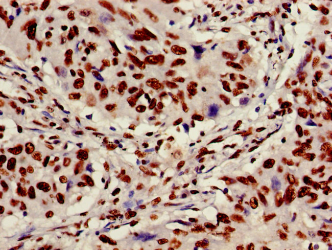 Ku70 Antibody in Immunohistochemistry (Paraffin) (IHC (P))