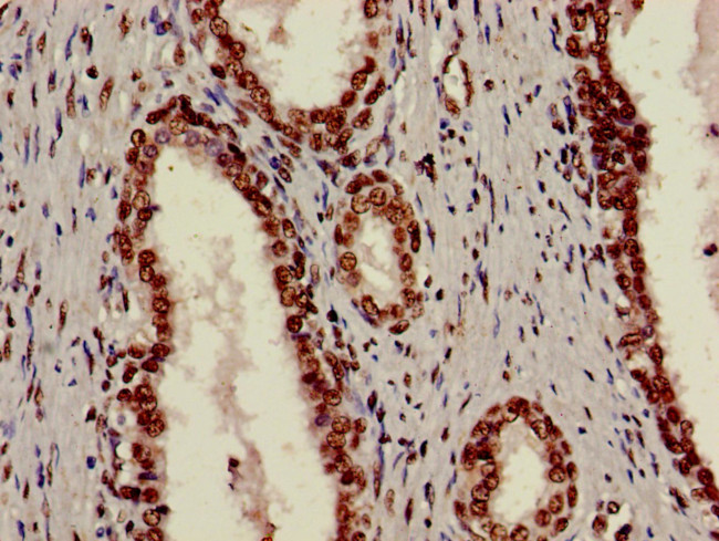 Ku70 Antibody in Immunohistochemistry (Paraffin) (IHC (P))