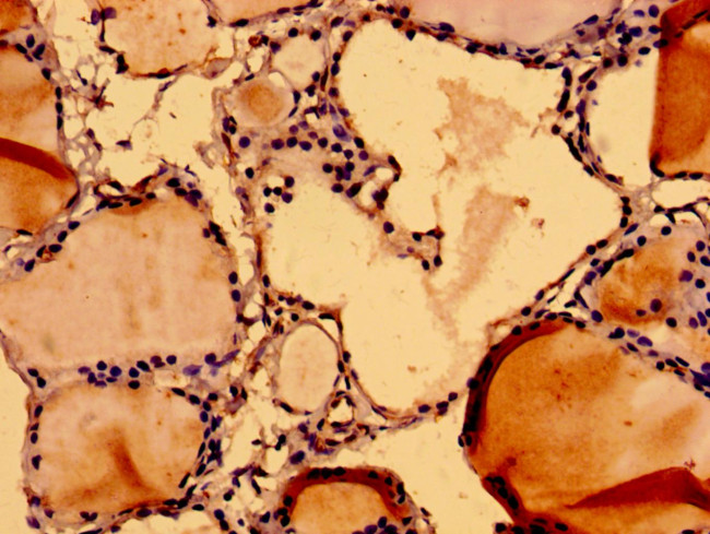 NuMA Antibody in Immunohistochemistry (Paraffin) (IHC (P))