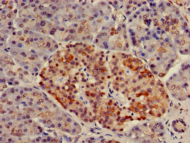 NUP107 Antibody in Immunohistochemistry (Paraffin) (IHC (P))