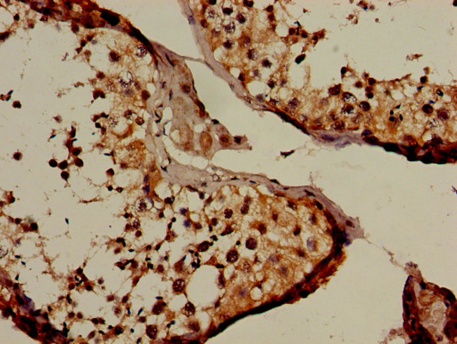 NUP107 Antibody in Immunohistochemistry (Paraffin) (IHC (P))