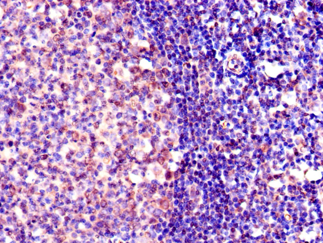 OGG1 Antibody in Immunohistochemistry (Paraffin) (IHC (P))