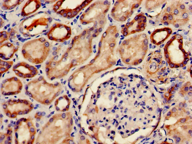 PDE2A Antibody in Immunohistochemistry (Paraffin) (IHC (P))