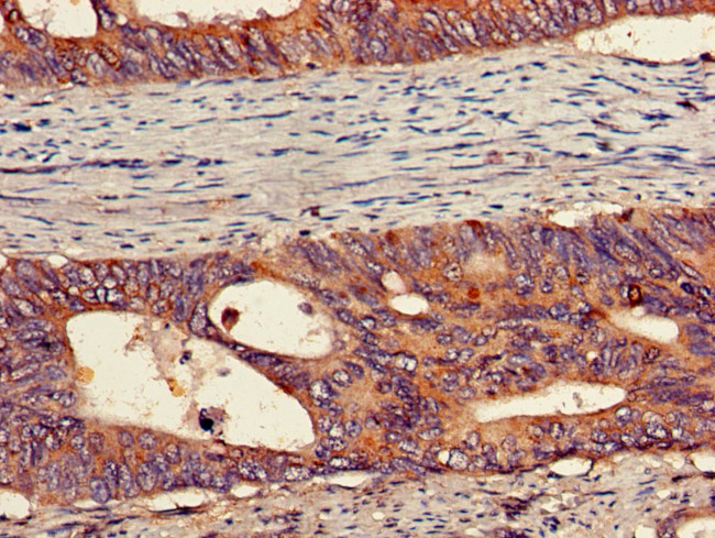 PEPD Antibody in Immunohistochemistry (Paraffin) (IHC (P))