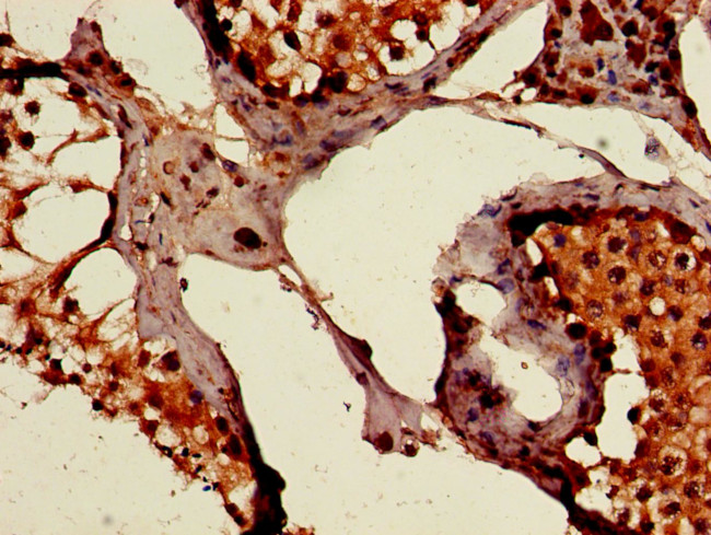 PEPD Antibody in Immunohistochemistry (Paraffin) (IHC (P))