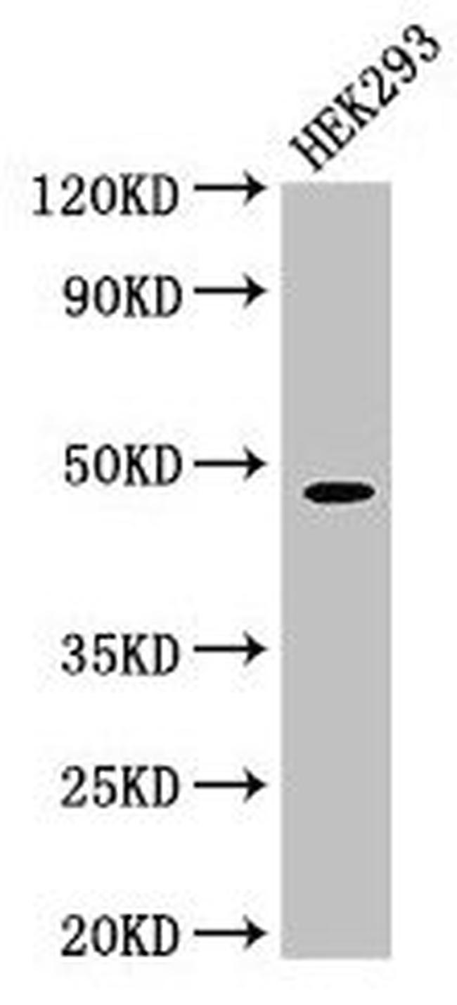 PEPD Antibody in Western Blot (WB)