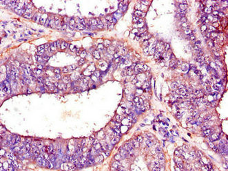 PFKM Antibody in Immunohistochemistry (Paraffin) (IHC (P))