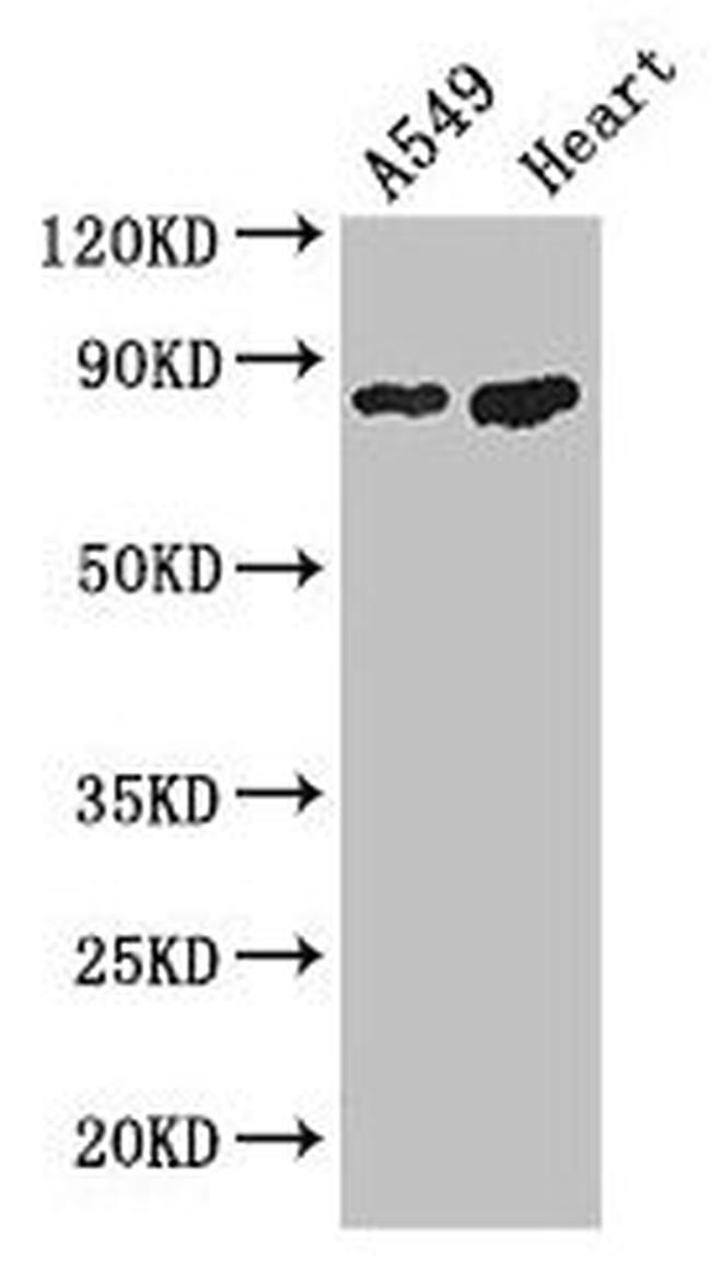 PFKM Antibody in Western Blot (WB)