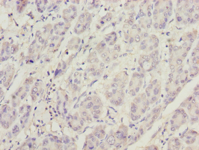 PHKG2 Antibody in Immunohistochemistry (Paraffin) (IHC (P))