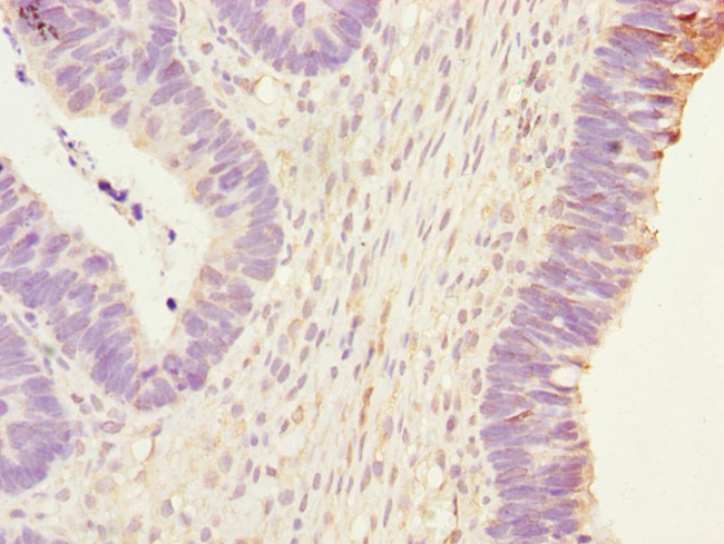 PHKG2 Antibody in Immunohistochemistry (Paraffin) (IHC (P))