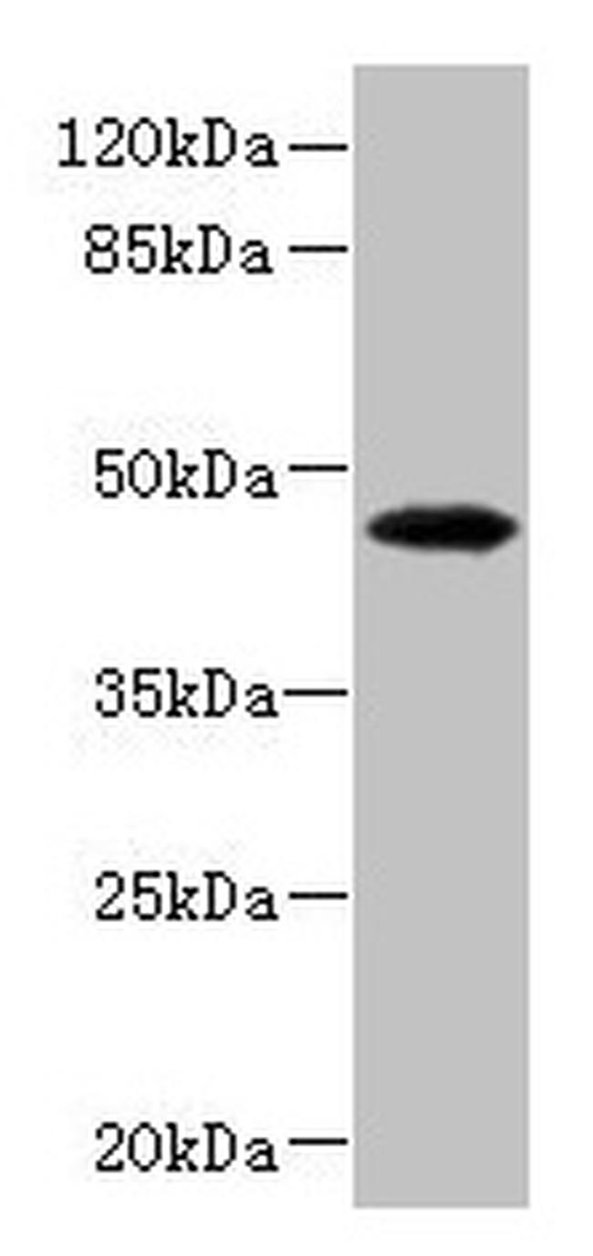 PHKG2 Antibody in Western Blot (WB)