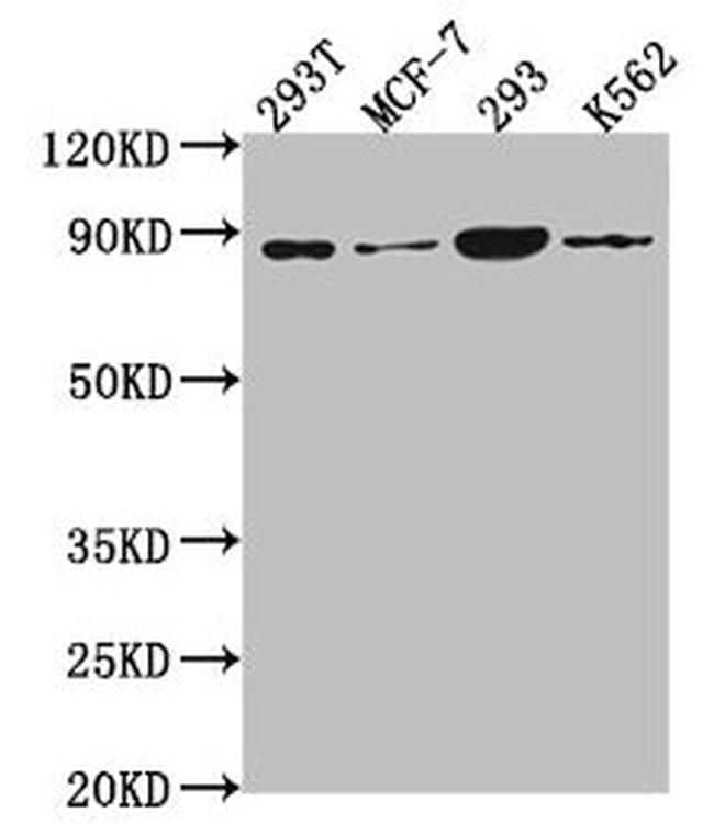 PLA2G4B Antibody in Western Blot (WB)