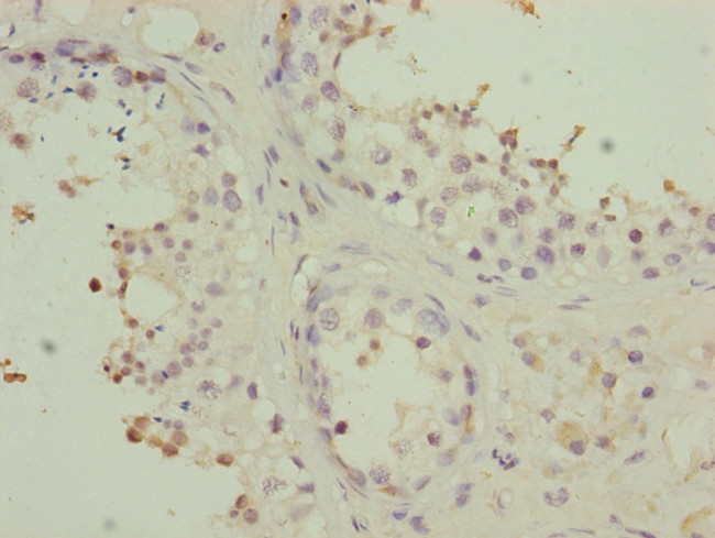 PMPCB Antibody in Immunohistochemistry (Paraffin) (IHC (P))